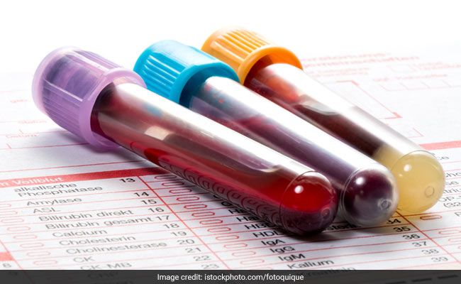 <b>essential-health-tests-every-indian-must-prioritize-for-optimal-well-being</b>